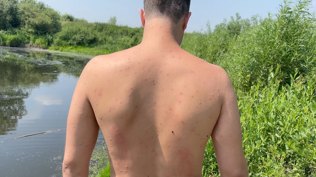 Как защитить себя от «болезни купальщиков», рассказали в Кореличском райЦГЭ